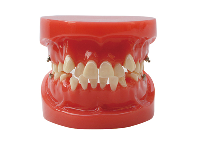 HST-B1 ORTHODONTIC MODEL