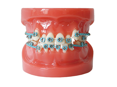 HST-B1-01 Ortho Metal Bracket Model