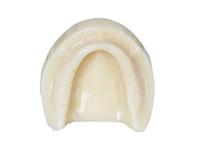 HST-T1 Implant Model